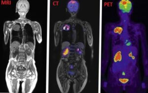 difference between MRI CT and scan