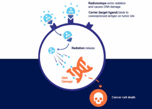 how radiation damages cancer cells graphic